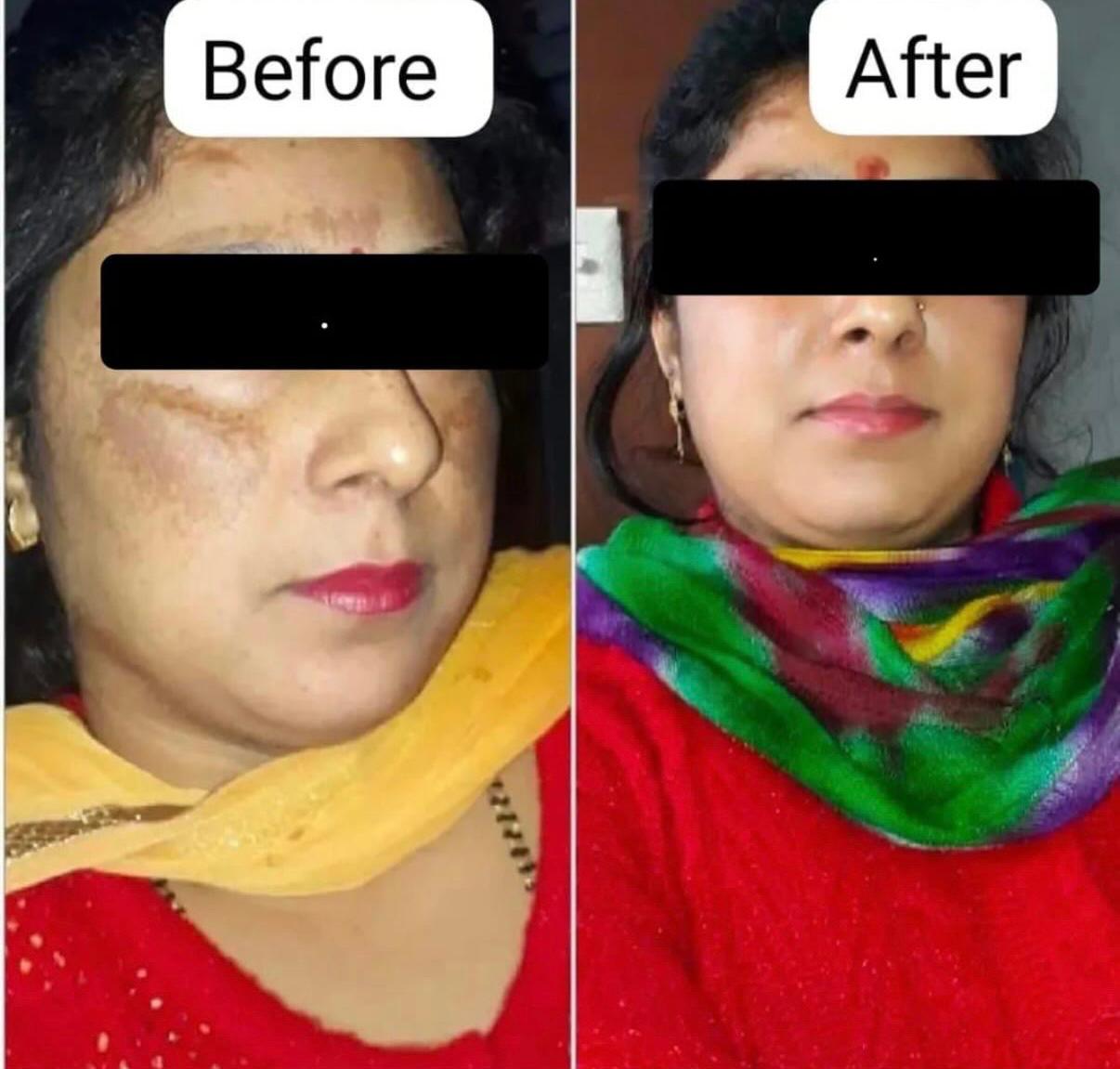 Geetanjali Advanced Glow Night Cream - 15 Days Glow Formula | For Men & Women | All Skin Types - (Prepaid Only)