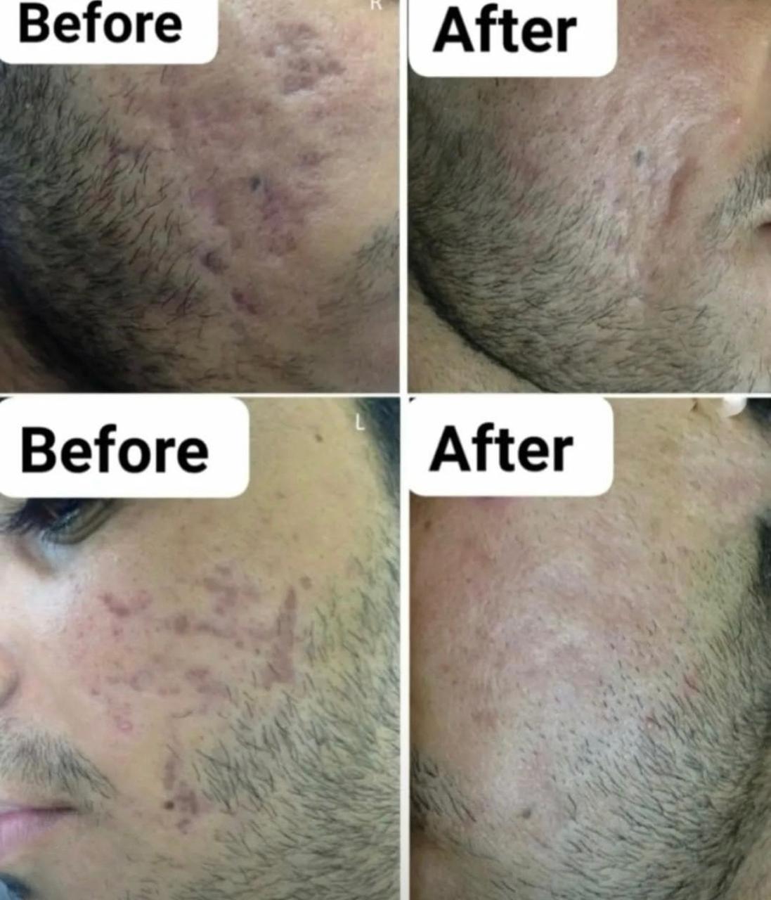 Geetanjali Advanced Glow Night Cream - 15 Days Glow Formula | For Men & Women | All Skin Types - (Prepaid Only)