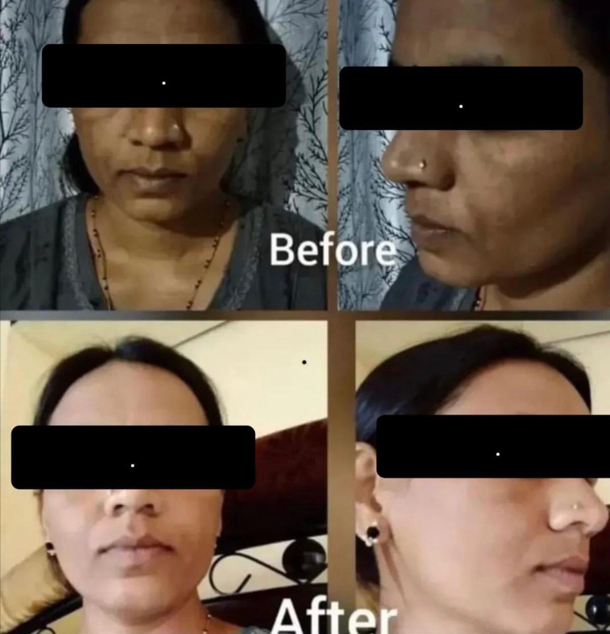 Geetanjali Advanced Glow Night Cream - 15 Days Glow Formula | For Men & Women | All Skin Types - (Prepaid Only)